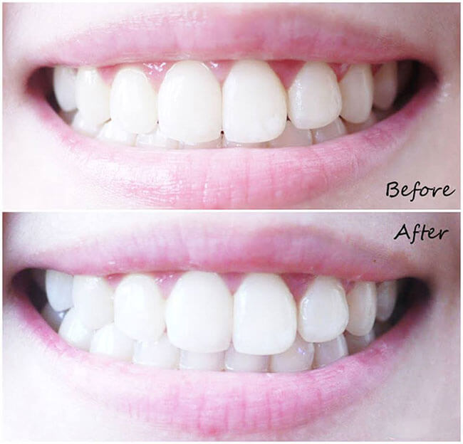Răng sẽ trắng sáng chắc khỏe hẳn lên chỉ sau 2 tuần sử dụng