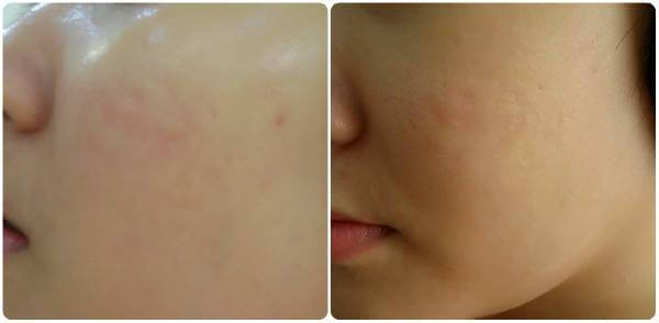 Thành phần Vitamin C bền vững tăng cường collagen giúp trẻ hóa làn da.  Thành phần Vitamin C bền vững tăng cường collagen giúp trẻ hóa làn da.